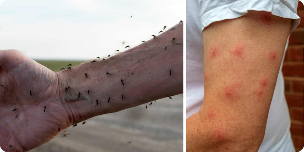Symptômes suite piqures de moustiques tigres à Lyon